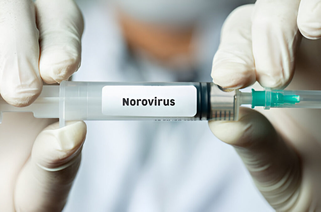 Noroviruso